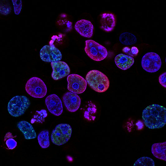 Fusobacterium nucleatum in Colorectal Cancer: What You Need to Know